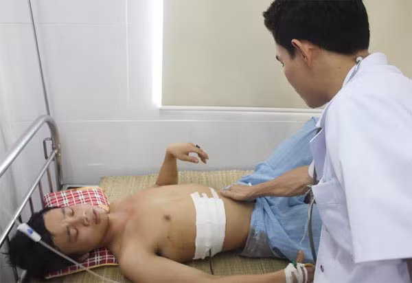 Nạn nhân Hồ Sỹ Hoàng đang điều trị tích cực tại bệnh viện.