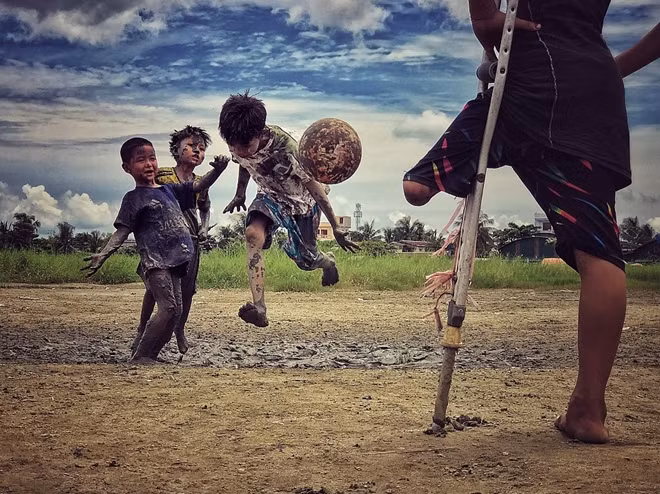 Giải ba đã thuộc về một bức ảnh cũng rất nhân văn của tác giả Zarni Myo Win (Myanmar). Bức ảnh cho thấy một cậu bé bị mất một chân đang đứng xem các bạn mình chơi đá bóng. "Cháu cũng muốn chơi cùng các bạn ấy, nếu có thể", tác giả kể lại.