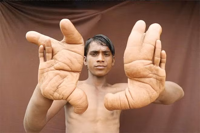 Chúng khổng lồ khiến nhiều người sợ.