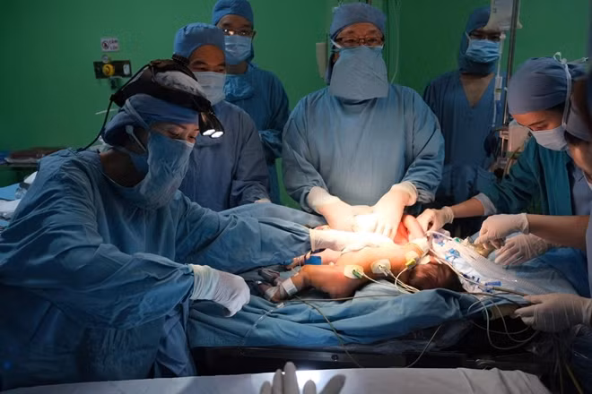 Hình ảnh Bé ( nằm vị trái tay trái) sau khi được tách rời an toàn.
