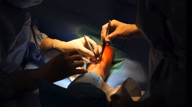 Ca Phẫu thuật Tạo đường rò động tĩnh mạch (FAV) cho bệnh nhân C.