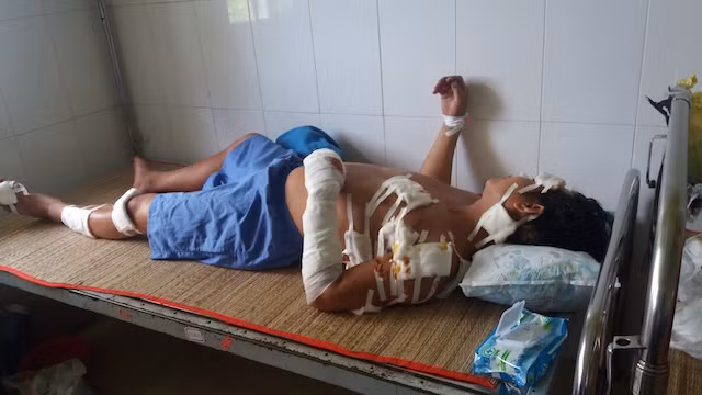 Người chồng bị chém gần 20 nhát. Người chồng bị chém gần 20 nhát.