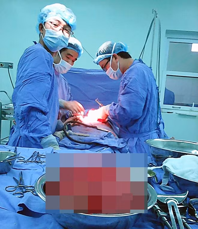 Các bác sĩ tiến hành ca mổ cắt bỏ khối u cho bệnh nhân N.