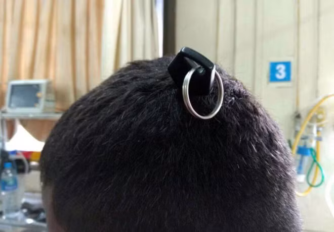 Nạn nhân may mắn thoát chết.