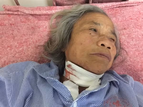 Bà Mận bị vết thương ở cổ. Bà Mận bị vết thương ở cổ.