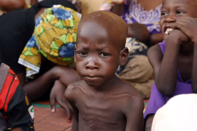 Trẻ em thiếu ăn ở Nigeria.