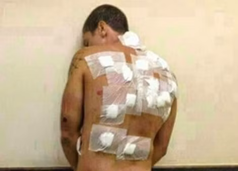 Hình ảnh khủng khiếp của tù nhân Daryell Dickson Menezes Xavier.