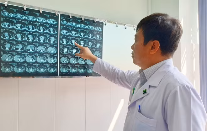 Bác sĩ kiểm tra hình ảnh chuẩn đoán của bệnh nhân.