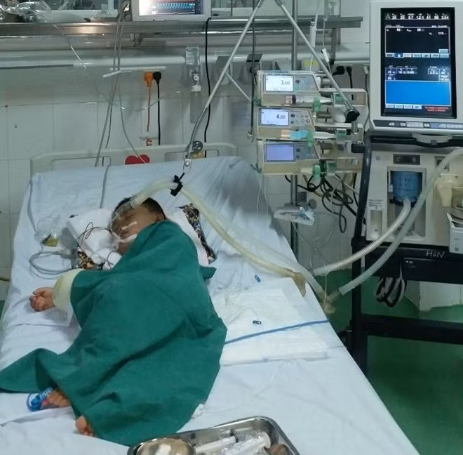 Cháu T. đang được cấp cứu tại BV Đà Nẵng trong tình trạng nguy kịch với 80 vết ong chích trên khắp cơ thể.
