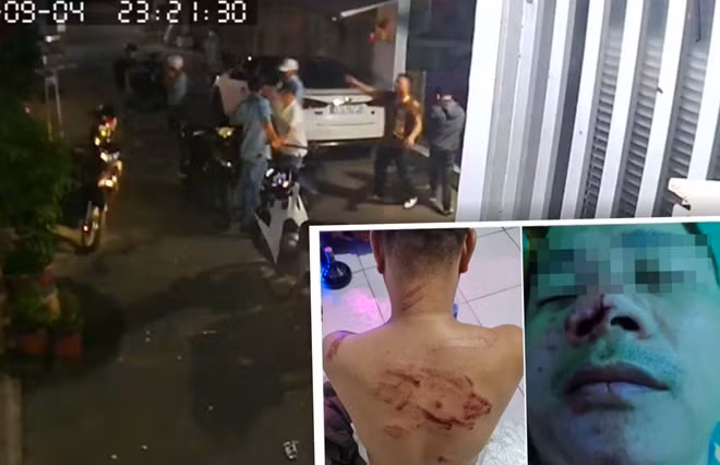 Nhóm đối tượng đánh chém anh V và hình nạn nhân thời điểm được cấp cứu
