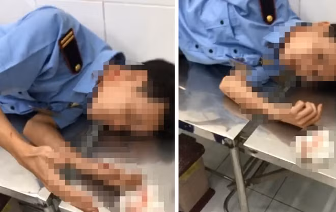Bảo vệ K thời điểm được đưa vào bệnh viện cấp cứu