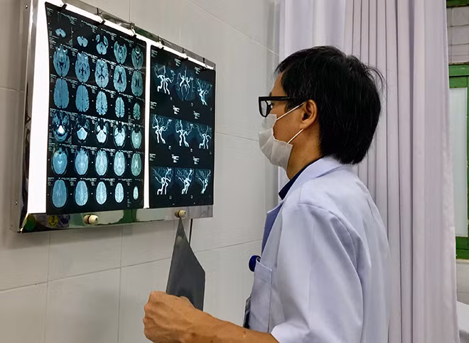 PGS.TS Đồng Văn Hệ kiểm tra phim chụp sọ não của bệnh nhân.