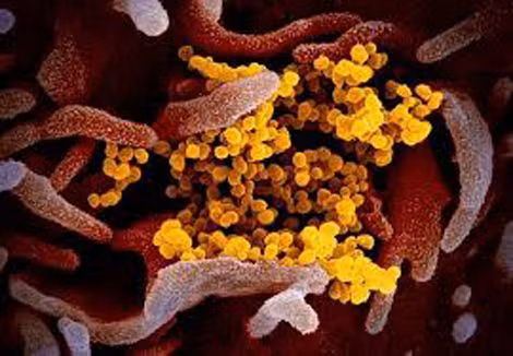 Virus SARS-CoV-2 đã đột biến, xuất hiện thêm hai chủng L và S mới, rất dễ lây truyền giữa người với người.