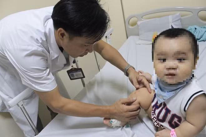 BS Trương Văn Quy kiểm tra vết phỏng cho bệnh nhi tay-chân-miệng.