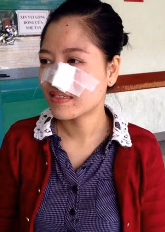 Dư luận không khỏi hoang mang khi liên tiếp xảy ra sự việc khỉ, heo rừng tấn công người dân và du khách gây thương tích tại Quảng Nam và TP Đà Nẵng.