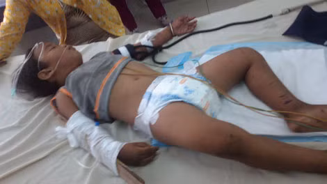 Cháu Luân đang được cấp cứu trong tình trạng nguy kịch. Cháu Luân đang được cấp cứu trong tình trạng nguy kịch.