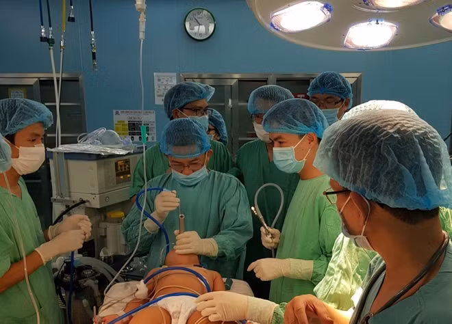 Các bác sĩ Bệnh viện T.Ư Huế soi thanh khí phế quản lấy dị vật nằm trong phế quản bệnh nhi.