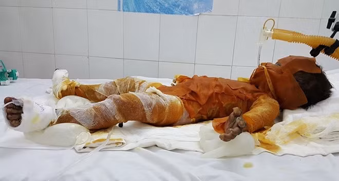 Hoàn cảnh gia đình cháy Uyên rất khó khăn.