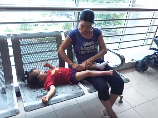 Một cháu bé bị bỏng do sơ suất của người lớn.
