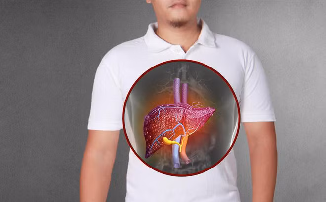 Các bệnh lý về gan được xem là "sát thủ thầm lặng". Các bệnh lý về gan được xem là "sát thủ thầm lặng".