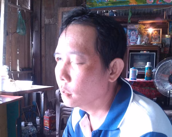 Ông Côn đang khốn khổ vì đi nhổ răng dẫn đến mù mắt.