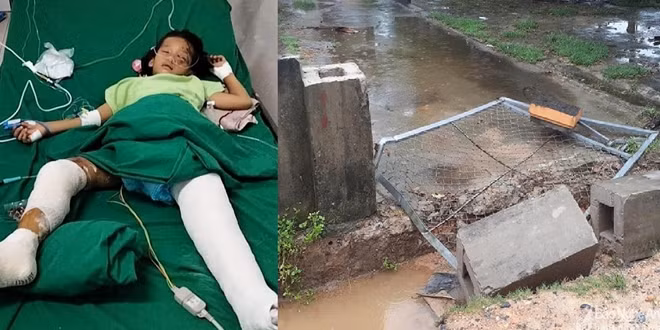 Chiếc cổng gãy đổ khiến cháu bé bị đa chấn thương phải nằm điều trị.