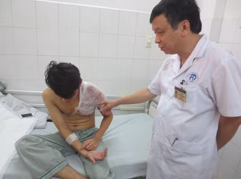 Bệnh nhân T đang điều trị tại Khoa Bỏng, Bệnh viện Đa khoa Xanh Pôn. Bệnh nhân T đang điều trị tại Khoa Bỏng, Bệnh viện Đa khoa Xanh Pôn.