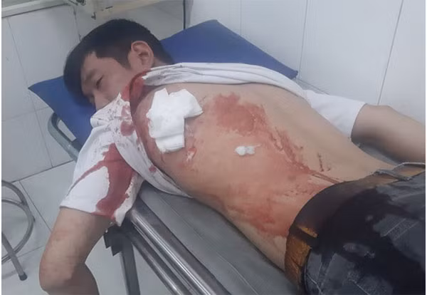 Anh D. khi được đưa vào Bệnh viện cấp cứu.