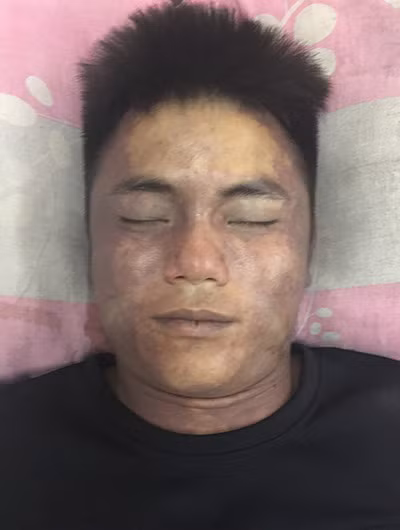 Ảnh chụp nạn nhân.