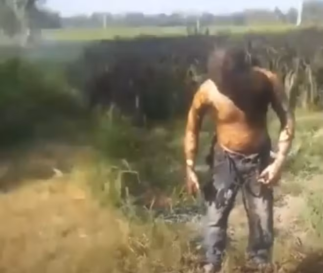 Hình ảnh nam thanh niên sau khi bị nhiều vết bỏng trên cơ thể . (Ảnh : Cắt từ clip do người dân ghi lại)