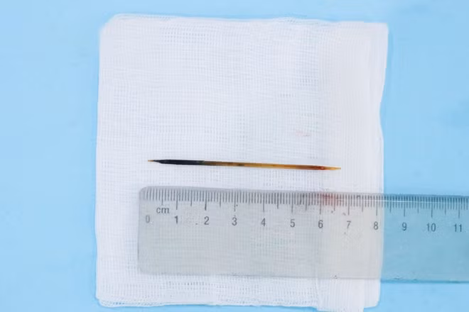 Cây tăm nhọn sắc dài 7 cm.