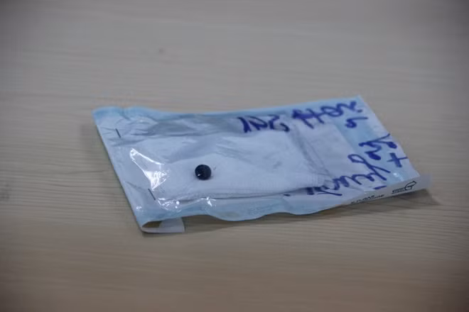 Đầu đạn được lấy ra khỏi mắt bệnh nhân.