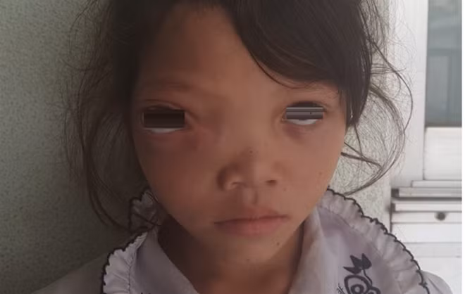Hình ảnh bệnh nhân trước mổ.