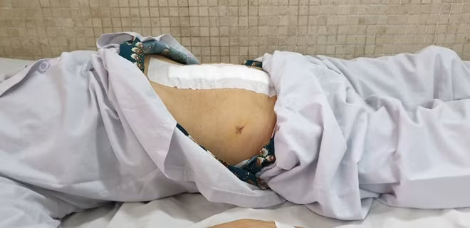 Sau mổ, bệnh nhân tạm ổn.