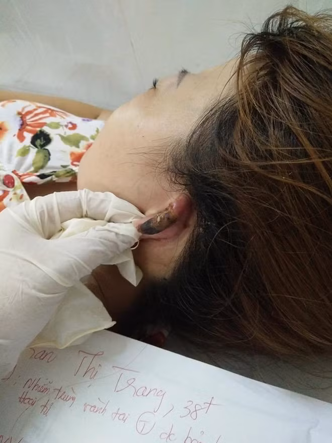 Cả hai trường hợp là cảnh báo điển hình về việc cần cẩn trọng khi đi làm đẹp tóc và cần biết cách sơ cấp cứu đúng khi bị bỏng.
