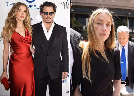 Johnny Depp và cô vợ trẻ Amber Heard (ảnh trái). Amber Heard với gương mặt tím bầm cáo buộc chồng cũ bạo lực.