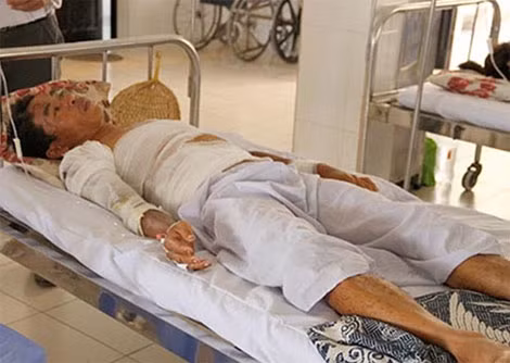 Sức khỏe bệnh nhân bị bỏng đang được các y bác sỹ theo dõi sát sao. Sức khỏe bệnh nhân bị bỏng đang được các y bác sỹ theo dõi sát sao.