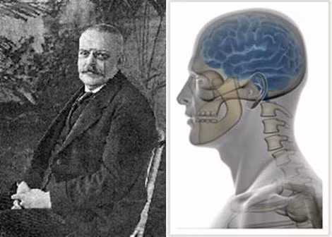 Bác sĩ A. Alzheimer, người đã khám phá ra "căn bệnh của thế kỷ XXI" (ảnh trái). Não người nhiễm chứng Alzheimer.