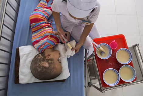 Có nhiều trẻ em, khi sinh ra thì khỏe mạnh. Nhưng sau đó phát triển trì trệ và trở thành tàn tật. Có nhiều trẻ em, khi sinh ra thì khỏe mạnh. Nhưng sau đó phát triển trì trệ và trở thành tàn tật.
