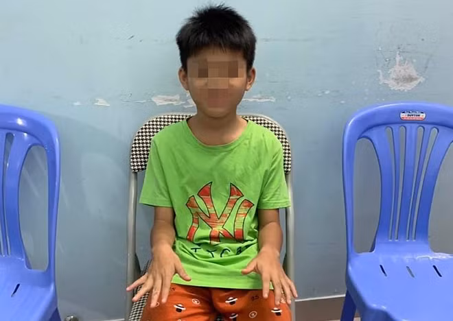 Cháu A. (ảnh do Công an cung cấp)