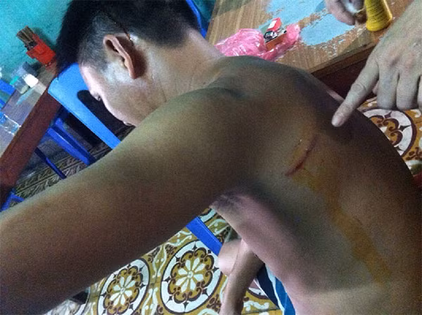 Ông Quảng bị nhiều thương tích trên người.