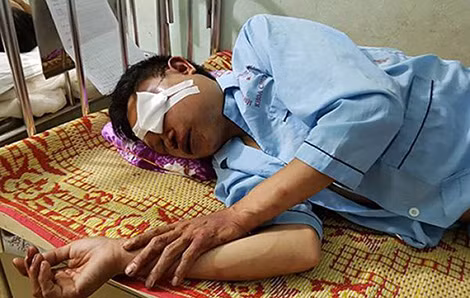 1 trong 2 nạn nhân bị người dân bắt nhầm, đánh đập phải nhập viện điều trị. 1 trong 2 nạn nhân bị người dân bắt nhầm, đánh đập phải nhập viện điều trị.