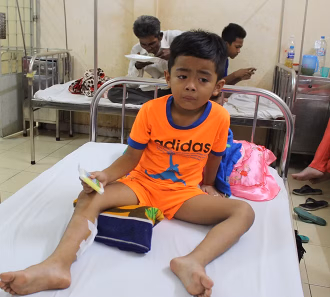 Cháu Đại đang điều trị tại Bệnh viện huyện Mỹ Xuyên.