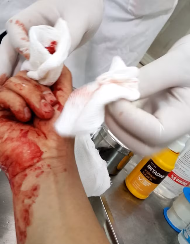Vết thương của nhà báo Đỗ Doãn Hoàng bị ba đối tượng hành hung.