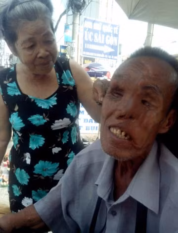 Ông yêu bà còn bà chỉ thương thôi.