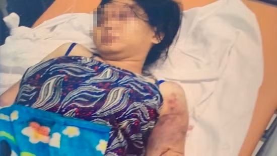 Y với nhiều vết thương trên người