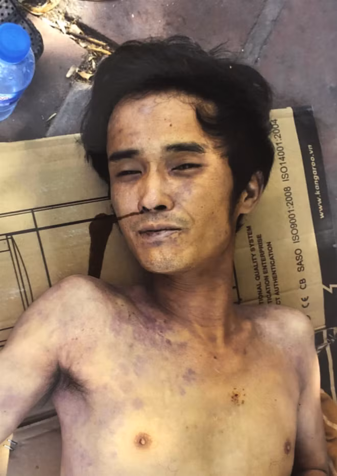 Nạn nhân chưa rõ thông tin