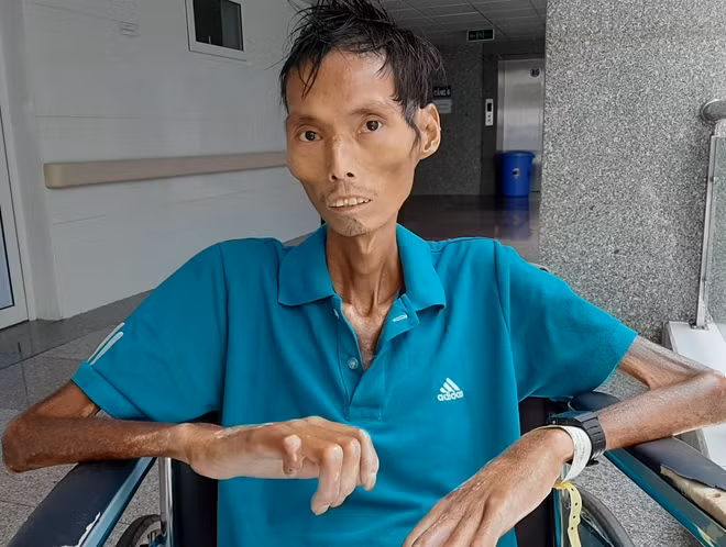 Anh Truyền với thân hình ngày càng khô quắt lại.