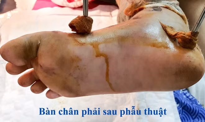 Và sau khi phẫu thuật đã hồng trở lại.