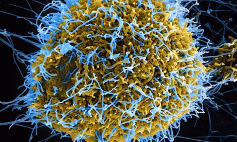 Mẫu virus Ebola có dạng sợi.